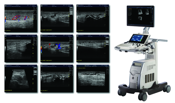 초음파 TOSHIBA ULTRASOUND SYSTEM / Aplio300 사진